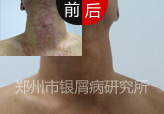 淶ƣʮ̼