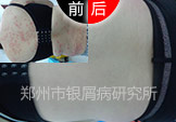 ꡱм Բ