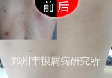 ߿ѹշм 淶δ