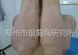 Ƥᣬ