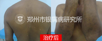 后.jpg