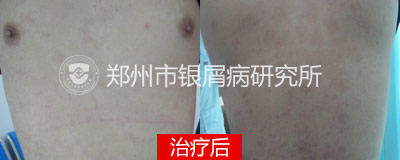 后.jpg